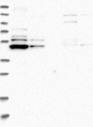 NBP1-83640 - TRMT61B