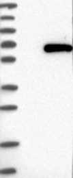 NBP1-83641 - TRMT61B