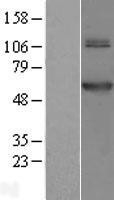 NBL1-10756 - TRMT61B Lysate