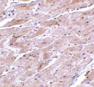 NBP1-76722 - TRPC3 / TRP3