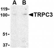 NBP1-76722 - TRPC3 / TRP3