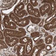 NBP1-85640 - TRPM6 / CHAK2