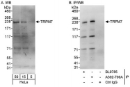 NBP1-46829 - TRPM7