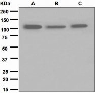NBP1-95576 - TRPM8