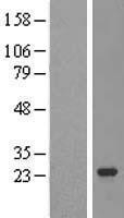 NBL1-17339 - TRPT1 Lysate