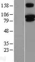 NBL1-17342 - TRPV3 Lysate