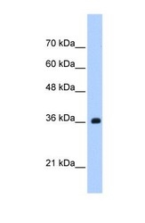 NBP1-57445 - TRSPAP1 / TRNAU1AP