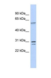 NBP1-57446 - TRSPAP1 / TRNAU1AP