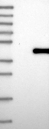 NBP1-92536 - TRSPAP1 / TRNAU1AP