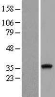 NBL1-17346 - TRSPAP1 Lysate