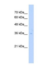 NBP1-56515 - TRUB2