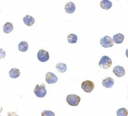 NBP1-76619 - Tuberin / TSC2