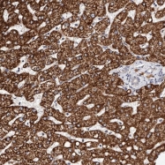 NBP1-82849 - Tuberin / TSC2