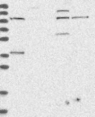 NBP1-82849 - Tuberin / TSC2