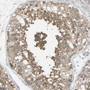 NBP1-81491 - TSC22D2