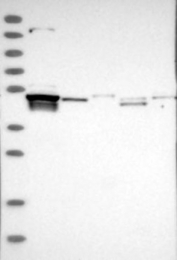 NBP1-81141 - TSEN2 / SEN2
