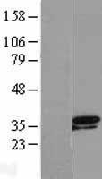 NBL1-17356 - TSEN34 Lysate