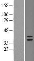 NBL1-17357 - TSFM Lysate
