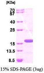 NBP1-44489 - TSG101