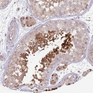 NBP1-92539 - TSKS