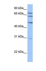 NBP1-54878 - TSKS