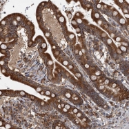 NBP1-80654 - TSNAXIP1 / TXI1