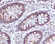 NBP1-95674 - TSPO / BZRP