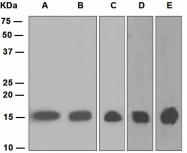 NBP1-95674 - TSPO / BZRP