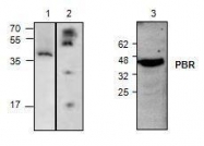 NBP1-45769 - TSPO / BZRP