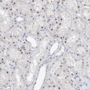 NBP1-86898 - TSPYL1 / TSPYL