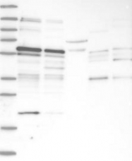 NBP1-86898 - TSPYL1 / TSPYL