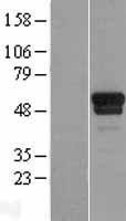 NBL1-17386 - TSPYL1 Lysate