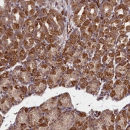 NBP1-92541 - TSPYL4