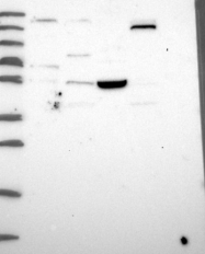 NBP1-92541 - TSPYL4
