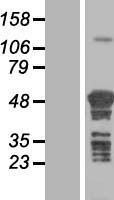 NBL1-17388 - TSPYL4 Lysate