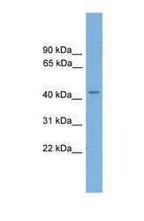 NBP1-52869 - TSPYL6