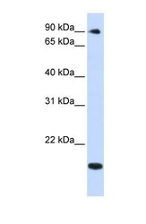 NBP1-55349 - TSR1