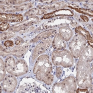 NBP1-85838 - TSSC4