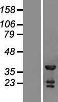 NBL1-17392 - TSSC4 Lysate