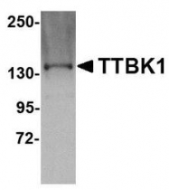NBP1-76989 - TTBK1