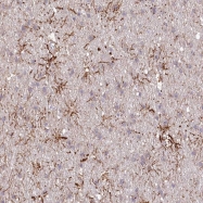 NBP1-86921 - TTC1 / TPR1