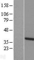 NBL1-17397 - TTC1 Lysate