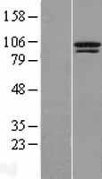 NBL1-17398 - TTC14 Lysate