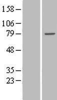 NBL1-17406 - TTC30B Lysate