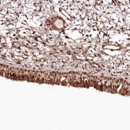 NBP1-82469 - TTC33