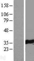 NBL1-17408 - TTC33 Lysate