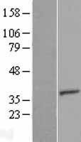 NBL1-17409 - TTC35 Lysate