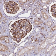 NBP1-81906 - TTC4