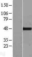 NBL1-17411 - TTC4 Lysate