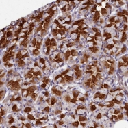 NBP1-92542 - TTC5
